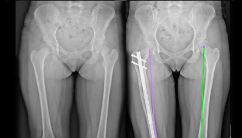 Leg Bones X-Ray MF Leggings - Limited